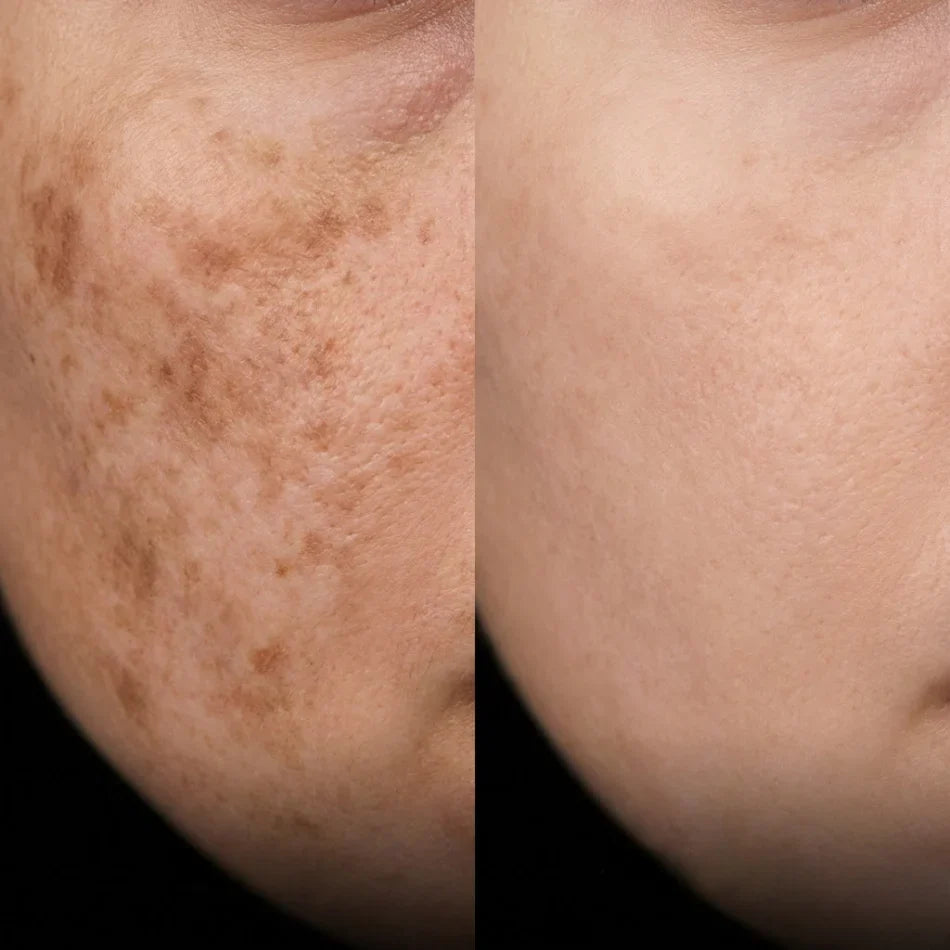 K·Skin Radiance Gummies Cream con Niacinamida + Ácido Hialurónico