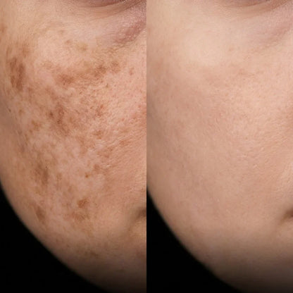 K·Skin Radiance Gummies Cream