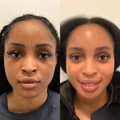 K·Skin Radiance Gummies Cream